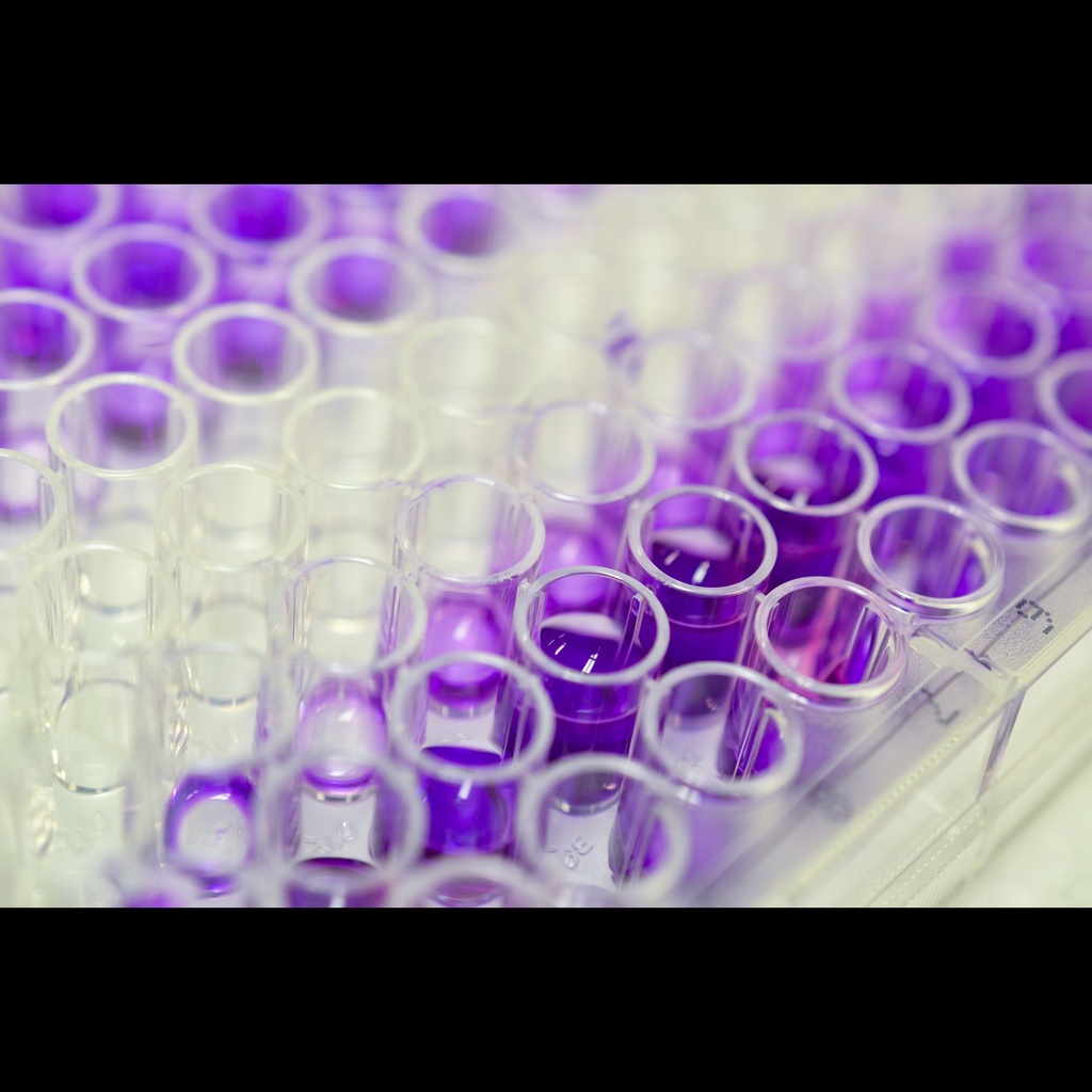 HIV Type 1 p24 Antigen ELISA ''5 X 96 Determinations''